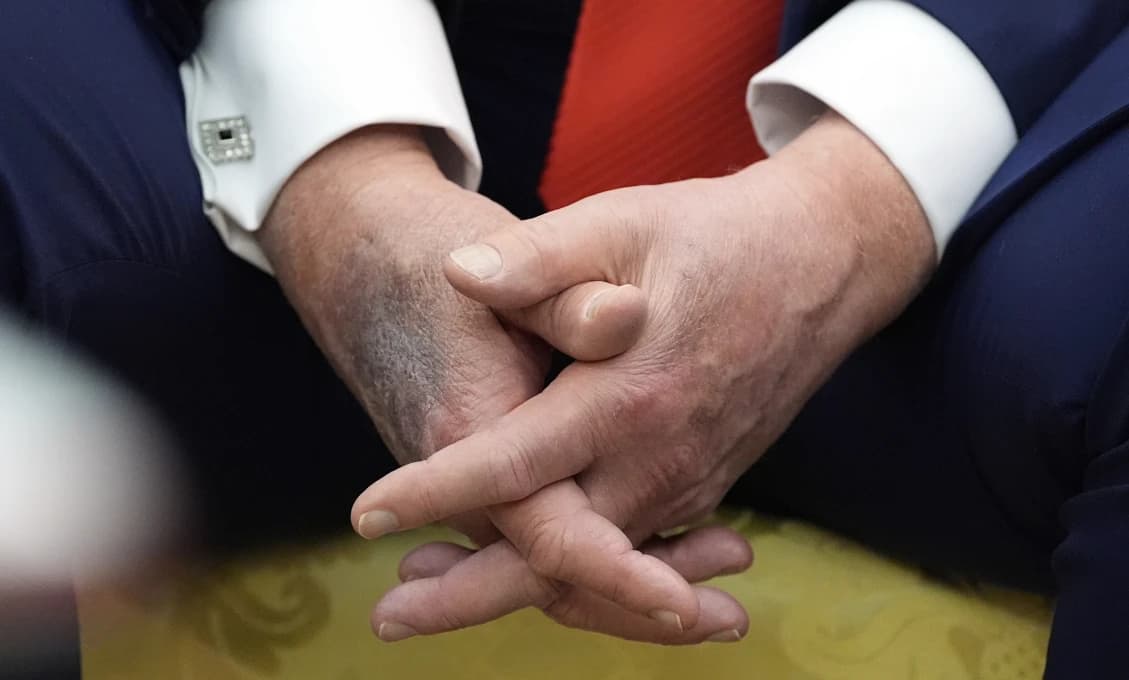 Trump reagoval na fámy o svojej bezprostrednej smrti, ktoré spustil Vance