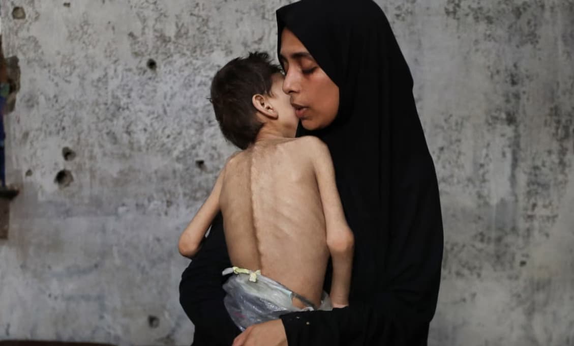 Gaza - živá výstava matiek s umierajúcimi synmi v náručí