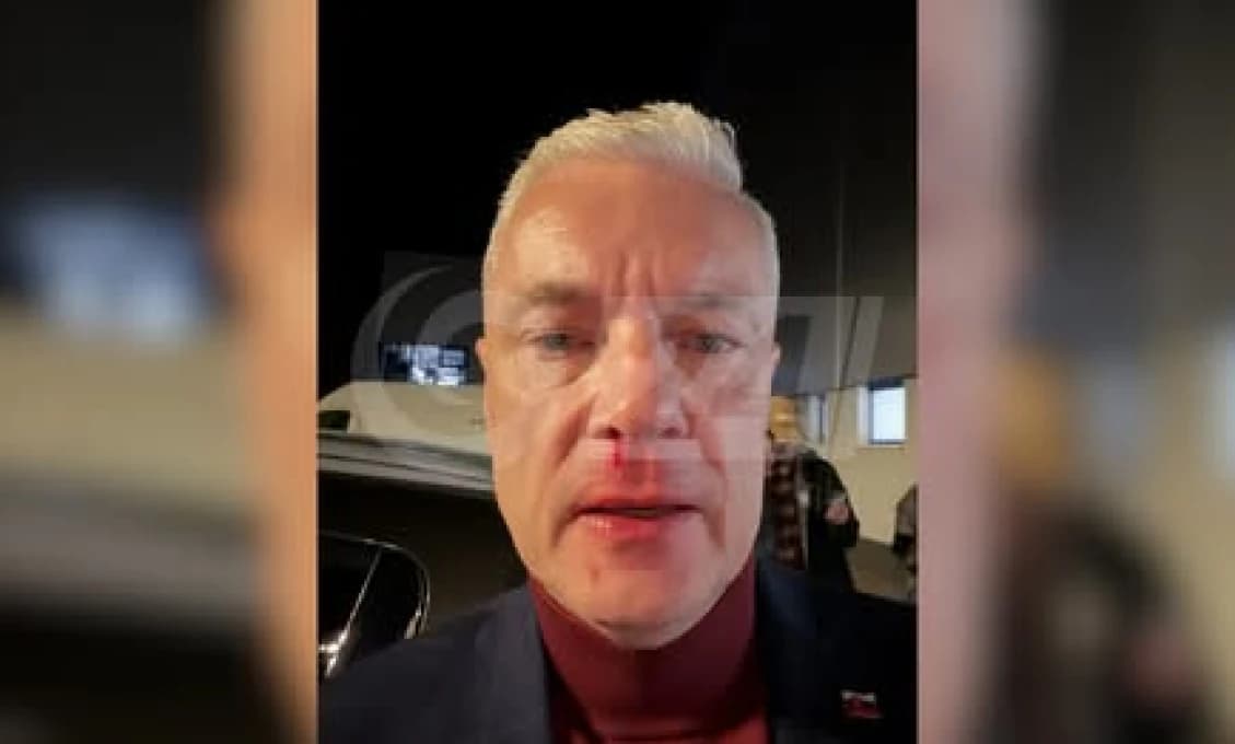 AKTUALIZOVANÉ Aktuality.sk sa sekli! Nie je pravda, že polícia zadržala útočníka, ktorý napadol politika Jána Ferenčáka